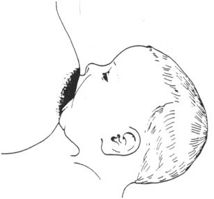 Gambar 2. Gambar pelekatan (tampak dari luar)